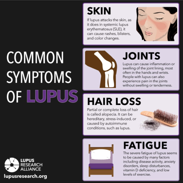 common-symptoms-of-lupus - Lupus Research